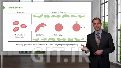 Spinal Cord Pathology - Medical Course | Carlo Raj | Lecturio
