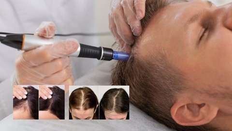 Hair Restoration Training: PRP + Microneedling (Dr. Pen)